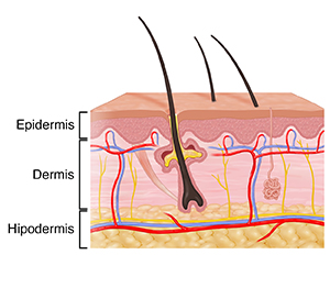 Corte transversal de la piel donde se ven la dermis, la epidermis y la hipodermis.