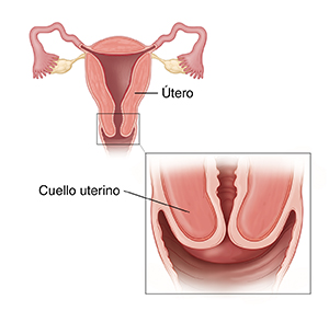 Corte transversal del útero con un recuadro que muestra un primer plano del cuello uterino.