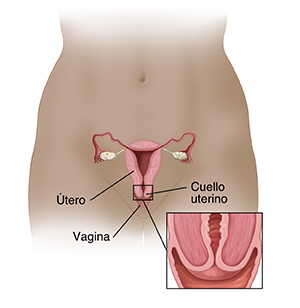 Vista frontal de la pelvis de una mujer, donde se observa un corte transversal del útero, de los ovarios, del cuello uterino, de la vagina y de las trompas de Falopio. En el recuadro, se observa un corte transversal del cuello uterino.