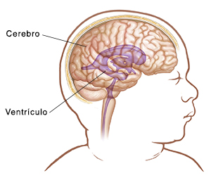 Imagen de ventrículo normal dentro del cerebro.