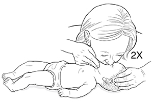 Mujer con las manos en la barbilla y la cabeza de un niño pequeño acostado boca arriba con la cabeza inclinada hacia atrás. Una mujer cubre la cara y la nariz de un niño pequeño con su boca para darle respiraciones de rescate.