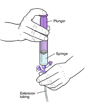 Closeup of hand holding extension tubing with syringe inserted in port. Other hand is pressing down plunger on syringe.