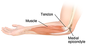 Side view of forearm, showing muscles, bones, and medial epicondyle at elbow..