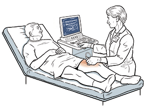 Hombre acostado en una mesa de examen. Una proveedora de atención médica sostiene una sonda de ecografía sobre la pierna del hombre.
