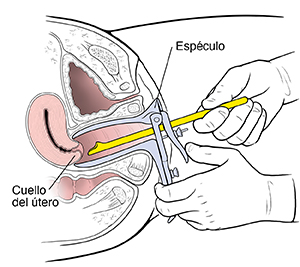 Corte transversal de la pelvis femenina donde se muestran unas manos que toman una muestra del cuello del útero para un Papanicolaou.