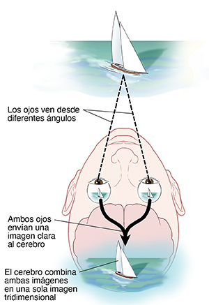 Vista de los ojos y el cerebro desde la parte superior de la cabeza que muestra cómo las imágenes de ambos ojos se procesan en el cerebro de forma normal.