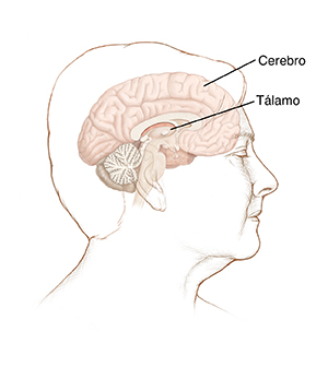 Vista lateral de la cabeza de una mujer en la que se ve un corte transversal del cerebro.