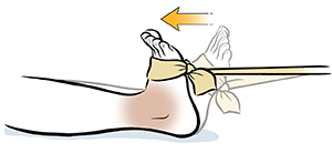 Un pie con banda elástica atada alrededor del antepié hace un ejercicio de dorsiflexión del tobillo.