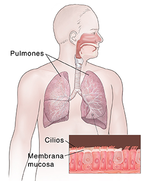Vista frontal de un hombre en donde se ve el sistema respiratorio. En el recuadro se muestran los cilios y moco.
