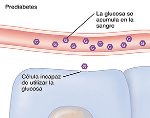 Corte transversal de un vaso sanguíneo y células que presentan demasiada glucosa en la sangre debido a la prediabetes.