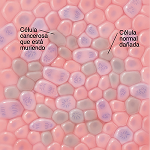 Vista microscópica de las células normales, las células dañadas, las células cancerosas y las células cancerosas que están muriendo.