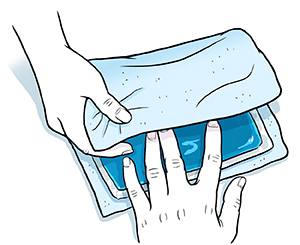 Primer plano de manos envolviendo una compresa de hielo en una toalla fina.