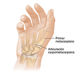 Vista de la palma de la mano donde se observan los huesos y la articulación carpometacarpiana.
