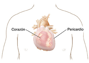 Vista frontal del pecho de un hombre donde se observa el corazón dentro del pericardio.